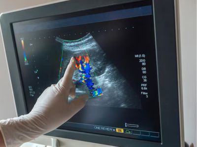 CT Scan at Raaya Diagnostic Centre